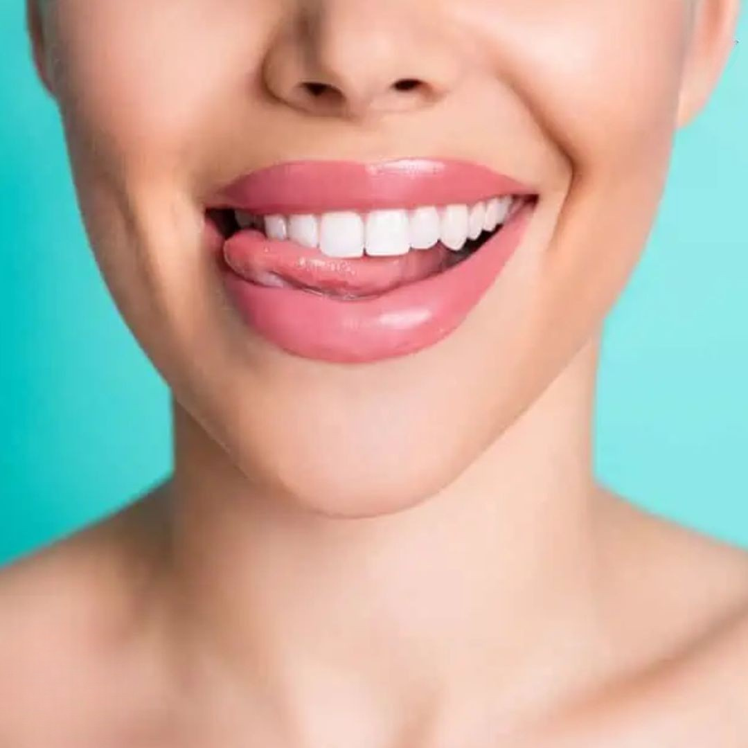 ToothPerfect™ | Get a perfect smile right away