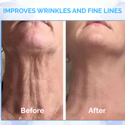 ClearSkin™ | Say goodbye to crepe and sagging skin - transform your look!