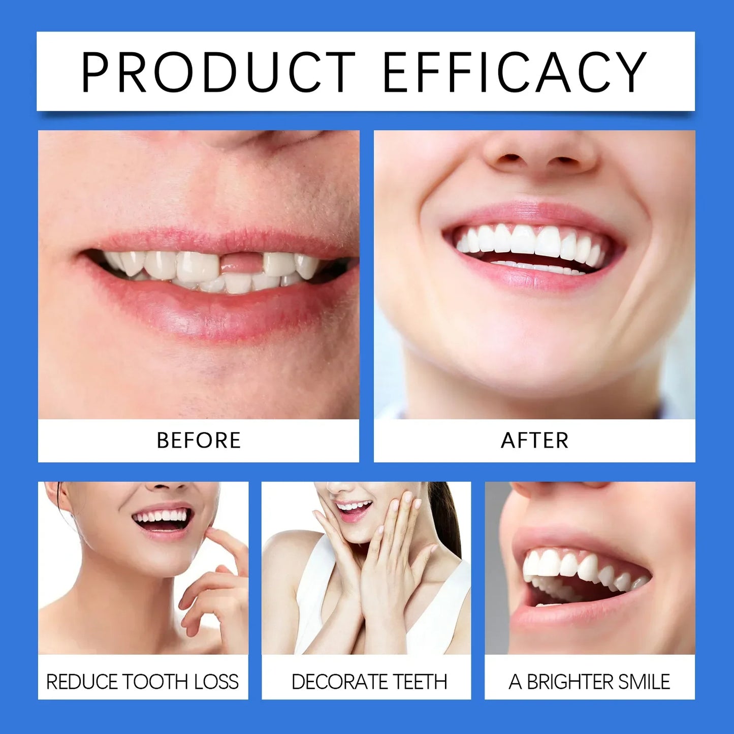 ToothPerfect™ | Get a perfect smile right away